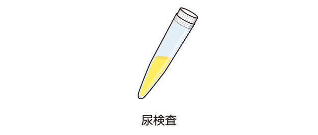 猫の慢性腎臓病 | ベーリンガーインゲルハイム アニマルヘルス